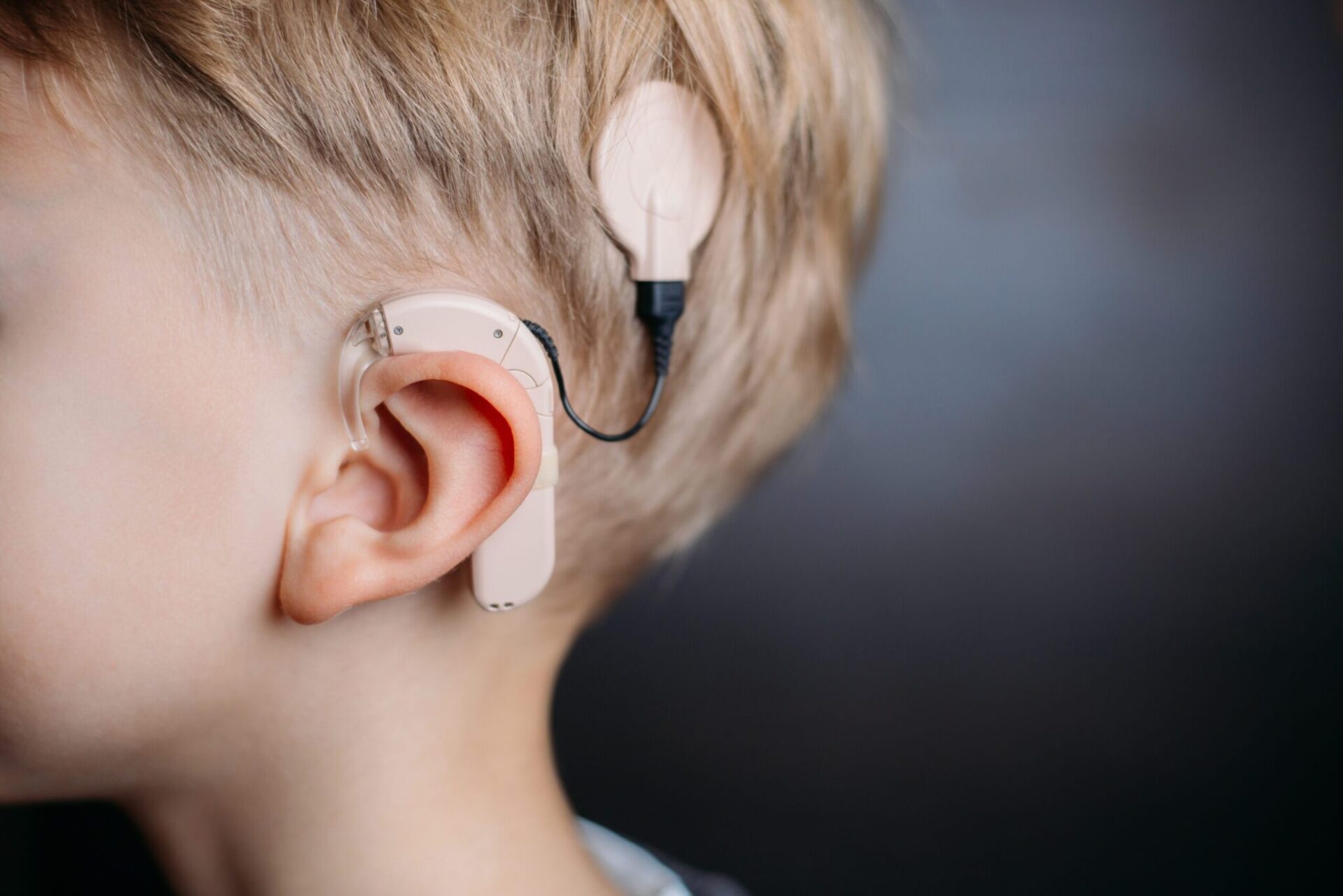 Boy with Cochlear implant on his head. / Child with hearing aid.